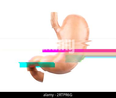 Realistic 3d illustration of anatomical model of human stomach with glitch effect, failure or disease concept Banque D'Images