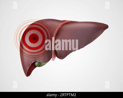 Concept de maladie ou de douleur du foie humain isolé sur blanc avec signe de douleur rouge dessus. illustration 3d. Banque D'Images