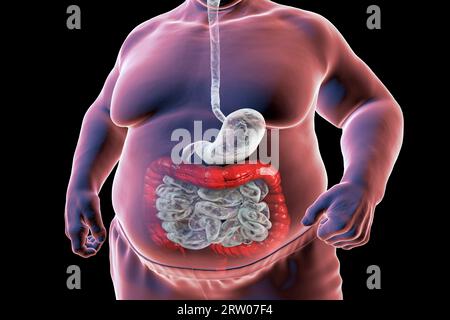 Système digestif de l'homme obèse, illustration Banque D'Images