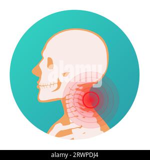 Localisation de douleur de cercle rouge dans le cou du corps humain, le squelette, les articulations et les os Illustration de Vecteur