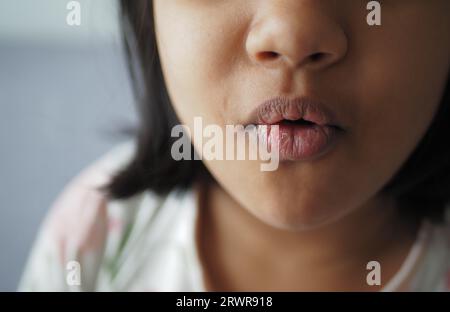 gros plan de la lèvre sèche d'un enfant Banque D'Images