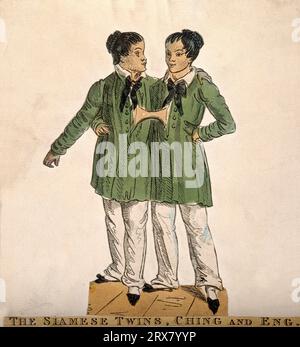 Chang et Eng les jumeaux siamois, 1811 – 1874, gravure colorée Banque D'Images