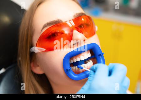 Dentiste applique le détecteur de gel de plaque dentaire à la jeune femme patient dans les dents de lunettes de protection orange dans la clinique dentaire. Banque D'Images