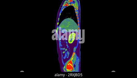 TDM thorax and abdomen avec plan sagittal de produit de contraste pour injection pour le diagnostic des douleurs thoraciques et abdominales. Banque D'Images