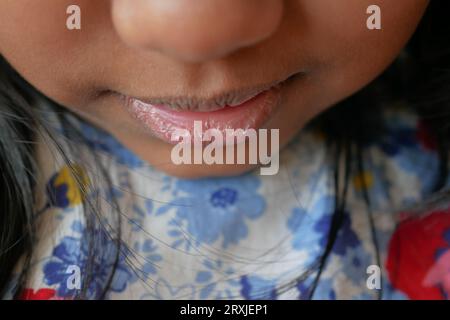 gros plan de la lèvre sèche d'un enfant Banque D'Images