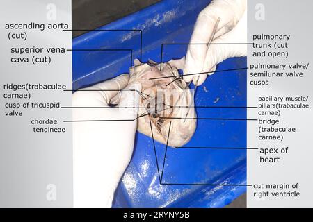 vue intérieure du ventricule droit montrant la valve mitrale, les cordages tendineux, les muscles papillaires et d'autres structures apparentées Banque D'Images