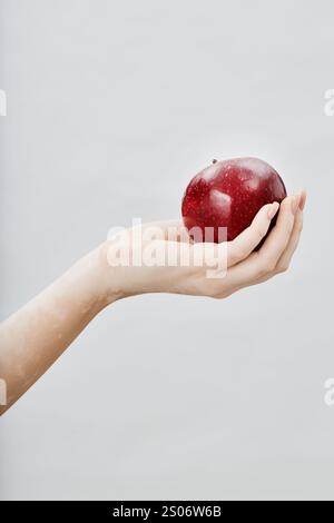 Gros plan vertical de la main féminine avec des patchs de vitiligo tenant une pomme tachetée rouge ressemblant à la peau des femmes dans le motif capturé sur fond blanc en studio, concept de beauté naturelle, espace de copie Banque D'Images