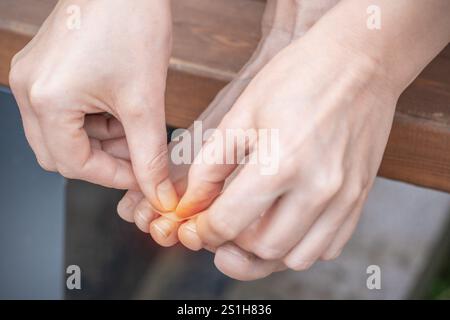 Gros plan d'une personne traitant les ongles incarnés à la main. Concentrez-vous sur les soins personnels, la santé et l'hygiène personnelle. Banque D'Images