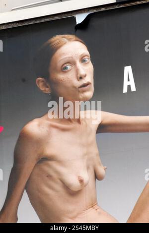 Répertoire photo, Italie. 11 janvier 2025. PHOTO D'ARCHIVE - CAMPAGNE PUBLICITAIRE CHOQUANTE CONTRE L'ANOREXIE PAR OLIVIERO TOSCANI - PAS D'ANOREXIE - LE MODÈLE ANOREXIQUE DANS LA PUBLICITÉ EST ISABELLE CARO (Milan - 2007-09-28, AZZARI/ipa-agency.net) ps la photo peut être utilisée dans le respect du contexte dans lequel elle a été prise, et sans intention diffamatoire du décorum des personnes représentées usage éditorial seulement crédit : Agence photo indépendante/Alamy Live News Banque D'Images
