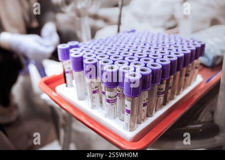 Jakarta, Indonésie - 30 mars 2022 : tubes à essai prêts à l'emploi pour don de sang placés sur un plateau dans une clinique Banque D'Images