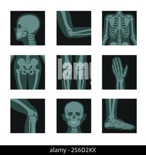 Clichés de rayons X du corps humain, images de la tête et des mains, des jambes et du vecteur de parties du corps. Roentgen de coude et côtes, hanches et genoux, paume et genou, pied. Les photos médicales des os ou du système squelettique anatomique. Radiographies du squelette et des os, tête et mains, jambes et articulations Illustration de Vecteur