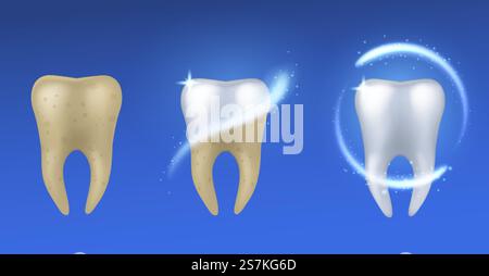 Dents blanchissantes. Dents blanches et jaunes réalistes avant et après le traitement de l'émail, les soins dentaires et la protection, concept de vecteur d'affiche d'hygiène buccale isolé sur fond bleu. Dents blanchissantes. Dents réalistes avant et après le traitement de l'émail, les soins et la protection dentaires, concept de vecteur d'affiche d'hygiène buccale Illustration de Vecteur