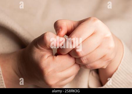 Femme stressée cueillant des clous. Anxiété et trouble de santé mentale. Gros plan de l'image des ongles laids. Banque D'Images