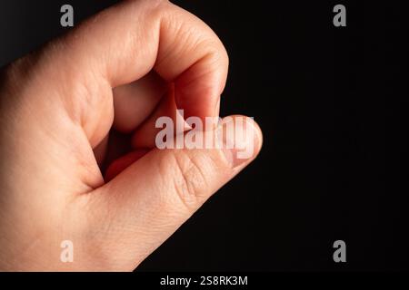 Femme stressée cueillant des clous. Anxiété et trouble de santé mentale. Gros plan de l'image des ongles laids. Banque D'Images