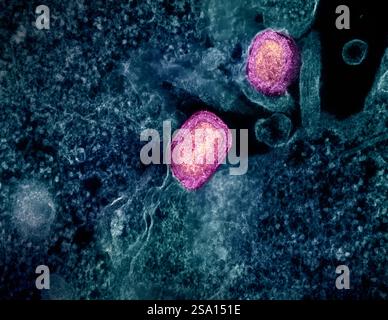 Micrographie électronique à transmission colorisée de deux particules matures du virus mpox (rose) fixées à la surface d'une cellule VERO E6 infectée (bleu/sarcelle). Banque D'Images