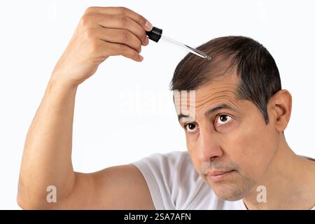 Traitement capillaire jeune homme. Massage sain à l'huile d'argan. Homme personne qui applique un produit pour arrêter la perte de cheveux. La thérapie compte-gouttes cosmétique liquide. Banque D'Images