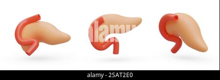 Pancréas réaliste. Sécrétion de suc pancréatique, insuline. Ensemble d'objets vectoriels dans différentes positions. Organe interne humain. Illustration vectorielle de couleur avec des ombres. Pancréas réaliste. Sécrétion de suc pancréatique, insuline Illustration de Vecteur