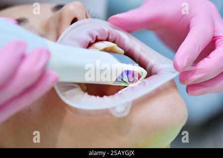 Gros plan des mains de dentiste dans des gants roses scaning les dents du patient avec scanner 3D dentaire et écran d'ordinateur portable avec balayage 3D de la mâchoire. Santé et stomie Banque D'Images