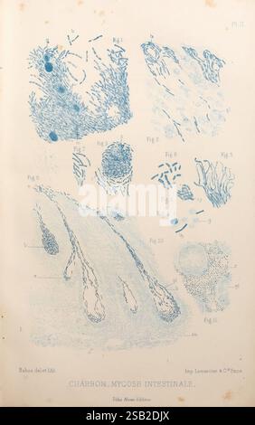 Les bactéries et leur rôle dans l'anatomie et l'histologie pathologiques des maladies infectieuses, Paris, F. Alcan, 1885, Bacteria, infections bactériennes, pathogénicité, pathologie, cette illustration présente une variété de figures scientifiques liées à la mycose intestinale, mettant en valeur des vues microscopiques détaillées des structures fongiques. La section supérieure comprend des diagrammes étiquetés qui décrivent différents éléments fongiques, mettant éventuellement en évidence leur morphologie et leur disposition. Les figures sont annotées avec des lettres et des chiffres à titre de référence, indiquant les caractéristiques ou les aspects spécifiques des spécimens examinés. T Banque D'Images