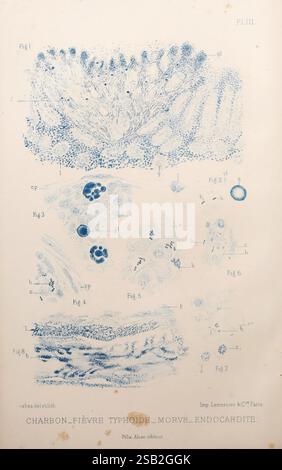 Les bactéries et leur rôle dans l'anatomie et l'histologie pathologiques des maladies infectieuses, Paris, F. Alcan, 1885. bactéries, infections bactériennes, pathogénicité, pathologie Banque D'Images