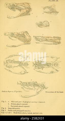 Serpents indiens, Madras, Higginbotham, 1874, Chine, Inde, serpents, Asie du Sud, Daboia russelii, taxonomie : sous-ordre = Serpentes, Journée mondiale du serpent, cette illustration présente des études anatomiques détaillées de la tête et des structures associées de l'espèce Dalogia degens, communément appelée Viperinae. Les figures étiquetées illustrent divers aspects de la dissection, mettant en évidence des parties anatomiques spécifiques. - **La figure 1** montre la peau et une section de l'enveloppe gingivale enlevée, donnant un aperçu des structures externes. - **La figure 2** illustre l'exposition de la glande empoisonnée, en insistant sur le o Banque D'Images