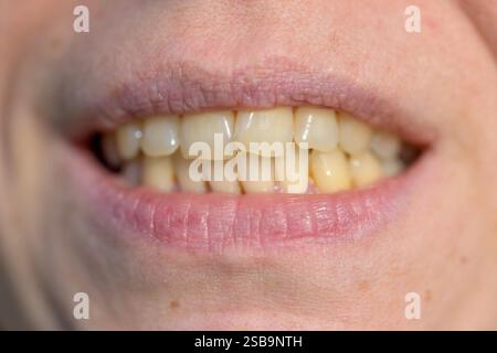 Une macro photographie détaillée capturant un sourire naturel, en se concentrant sur la texture des lèvres et l'alignement des dents. Banque D'Images
