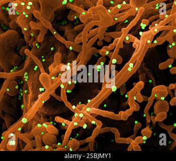Micrographie électronique à balayage colorisé d'une cellule (orange) infectée par des particules du virus SARS-CoV-2 (vert), isolée d'un échantillon de patient. Banque D'Images