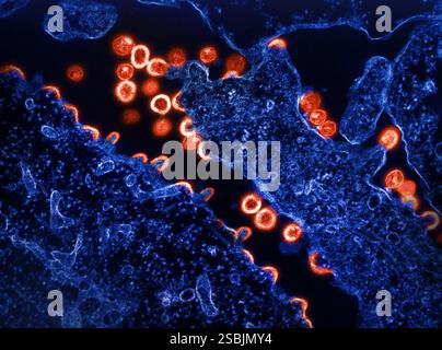 Micrographie électronique par transmission des particules virales VIH-1 (rouge) bourgeonnant et se répliquant à partir d'un segment d'une cellule H9 infectée chroniquement (bleu). Les particules sont à divers stades de maturité ; les arcs/demi-cercles sont des particules immatures qui ont commencé à se former mais qui font toujours partie de la cellule. Les particules immatures changent lentement de morphologie en formes matures et présentent le ‚Äúconical classique ou noyau sphérique. ‚Äù image capturée au NIAID Integrated Research Facility (IRF) à Fort Detrick, Maryland. Banque D'Images