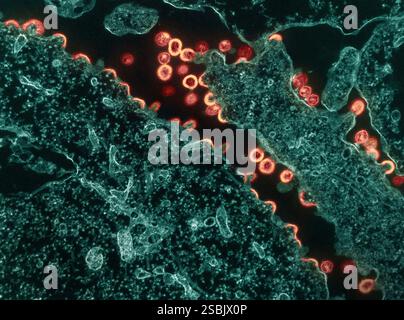 Micrographie électronique par transmission des particules virales VIH-1 (rouge/or) bourgeonnant et se répliquant à partir d'un segment d'une cellule H9 infectée chroniquement. Les particules sont à divers stades de maturité ; les arcs/demi-cercles sont des particules immatures qui ont commencé à se former mais qui font toujours partie de la cellule. Les particules immatures changent lentement de morphologie en formes matures et présentent le ‚Äúconical classique ou noyau sphérique. ‚Äù image capturée au NIAID Integrated Research Facility (IRF) à Fort Detrick, Maryland. Banque D'Images