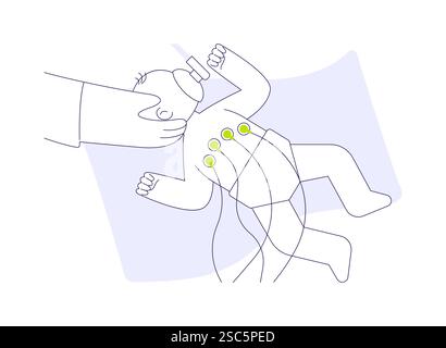 Illustration vectorielle abstraite de la chirurgie néonatale. Illustration de Vecteur