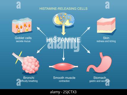 Histamine. Réponse immunitaire et réaction allergique. Les cellules libérant de l'histamine produisent de l'histamine puis l'estomac sécrète de l'acide gastrique, le muscle lisse est Illustration de Vecteur