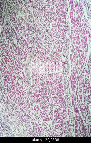 Muscle cardiaque enflammé sous le microscope 100x Banque D'Images