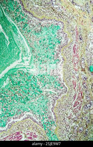 Tissu pulmonaire asthmatique au microscope Banque D'Images