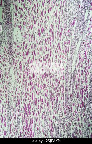 Muscle cardiaque enflammé sous le microscope 100x Banque D'Images