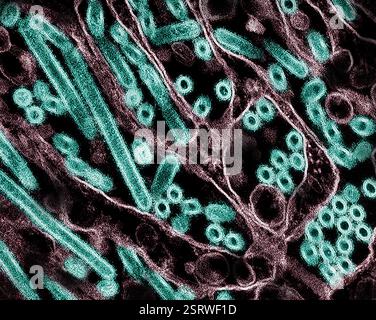Virus de l'influenza aviaire A (H5N1/grippe aviaire) micrographie électronique à transmission colorée des particules du virus de l'influenza aviaire A H5N1 (jaune), cultivées dans des cellules épithéliales (bleues) du rein canin de Madin-Darby (MDCK). Microscopie par CDC ; repositionnée et recolorée par NIAID. Banque D'Images