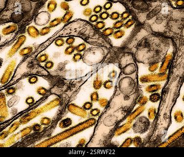 Virus de l'influenza aviaire A (H5N1/grippe aviaire) micrographie électronique à transmission colorée des particules du virus de l'influenza aviaire A H5N1 (jaune), cultivées dans des cellules épithéliales (bleues) du rein canin de Madin-Darby (MDCK). Microscopie par CDC ; repositionnée et recolorée par NIAID. Banque D'Images