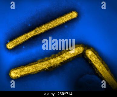 Atlanta, États-Unis. 20 décembre 2024. Trois particules du virus de la grippe aviaire A - H5N1 colorées en jaune pour la détection sur fond dans un microscope électronique au siège du CDC, le 20 décembre 2024 à Atlanta, en Géorgie. Crédit : CDC/NIAID/Alamy Live News Banque D'Images