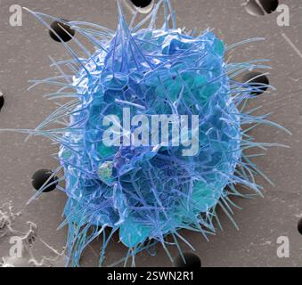 Acanthocystis. Micrographie électronique à balayage coloré (MEB) d'un héliozoaire centrohelide à écailles tangentielles et épines radiales. Ce genre Acanthocystis contient des organismes vivants unicellulaires, planctoniques ou benthoniques flottants qui sont communs en eau douce mais aussi plus rarement trouvés dans les habitats marins. La position évolutive des centrohelids n'est pas claire. Grossissement : x 2500, si imprimé 10 centimètres Banque D'Images