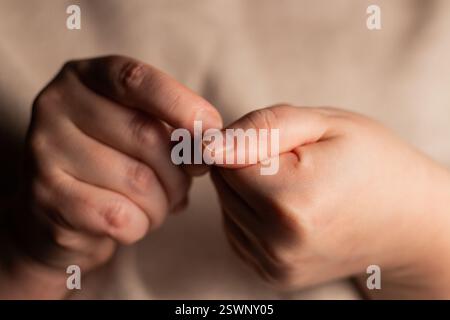 Femme stressée cueillant des clous. Anxiété et trouble de santé mentale. Gros plan de l'image des ongles laids. Banque D'Images