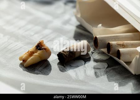 Cigarettes et une molaire noire arrachée se trouvent sur une radiographie dentaire panoramique, carie dentaire due à la nicotine, mauvaises dents d'un fumeur Banque D'Images