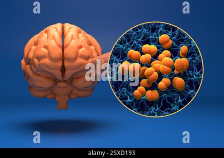 Neisseria meningitidis (méningocoque) bactérias dans le cerveau (infection à la méningite) - 3D illustration vue isométrique Banque D'Images