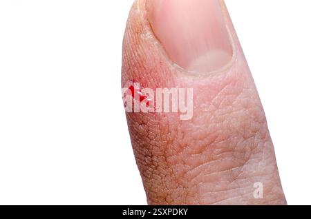 Plaie sur le doigt d'un homme gros plan Banque D'Images