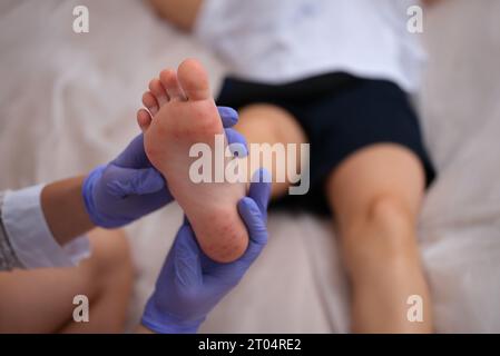 Maladie infectieuse médecin examinant une éruption cutanée sur la peau de l'enfant pieds de près Banque D'Images