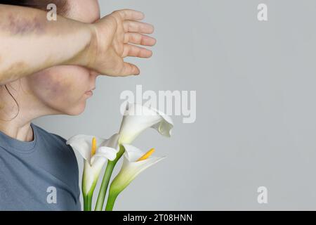 Arrêter les abus et la violence domestique concept. Belle femme avec des problèmes bleus cachant son visage et tenant la fleur de lys blanc sur fond de bannière gris Banque D'Images