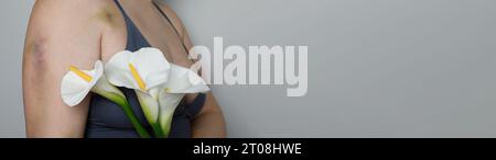 Gros plan de belle femme femme avec blessure ecchymose et fleur de lys. Problème social et concept d'arrêt de la violence Banque D'Images