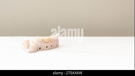 Couronne de dent de bannière ou chapeau dentaire dans la boîte, support de dent de modèle d'implant sur la table blanche. Copier l'espace pour le texte. Livraison Crown. Positionnement du pont. Horizontal Banque D'Images
