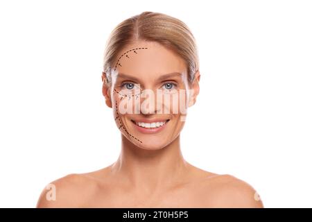 Femme avec des marques pour la chirurgie esthétique sur son visage sur fond blanc Banque D'Images