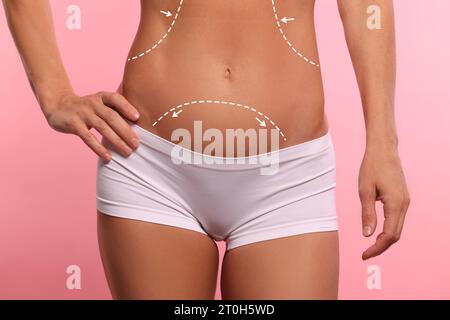 Femme avec des marques pour la chirurgie esthétique sur son abdomen sur fond rose, gros plan Banque D'Images