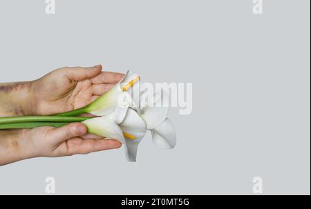 Fleur de lys blanc dans la main de femme avec des problèmes ecchymose sur fond blanc avec espace de copie Banque D'Images
