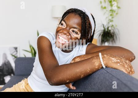 Heureuse jeune femme africaine avec vitiligo regardant loin se détendre sur le canapé à la maison Banque D'Images